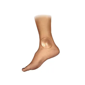Bunga Pads Gel Blister Cushion Pad