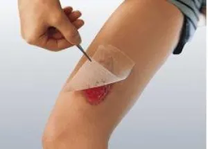 Cuticerin Gauze Dressing 3" x 3" [Box of 10]