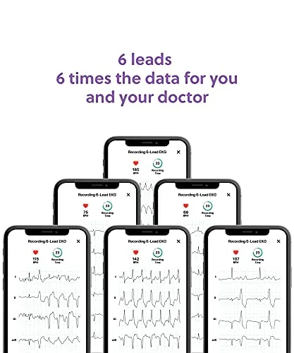 KardiaMobile 6-Lead Personal EKG Monitor   6 Arrhythmia Detections | Doctor Recommended | Detects AFib and PVCs | Medical-Grade and FDA-Cleared