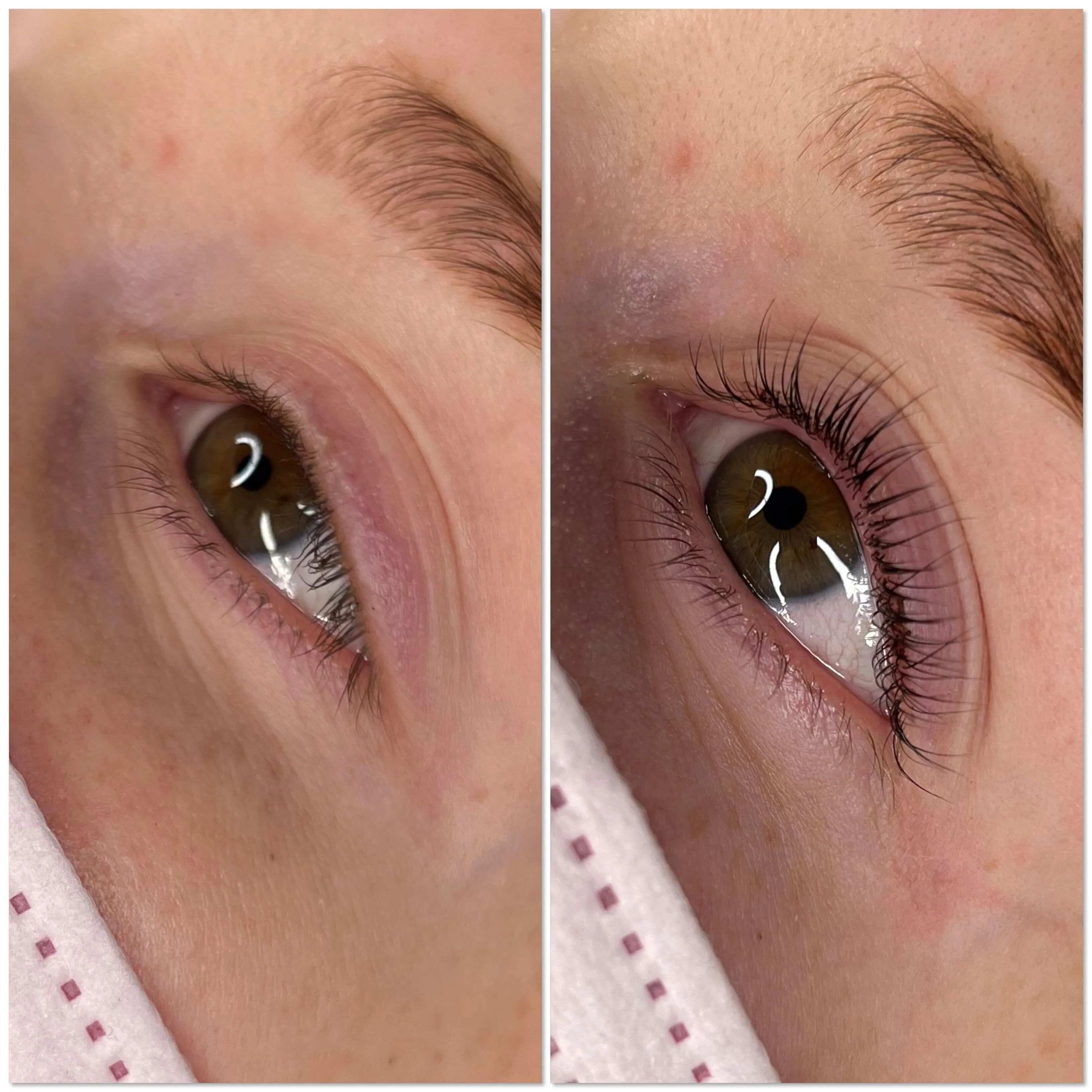 Lifted. Pro Treatment Bundle