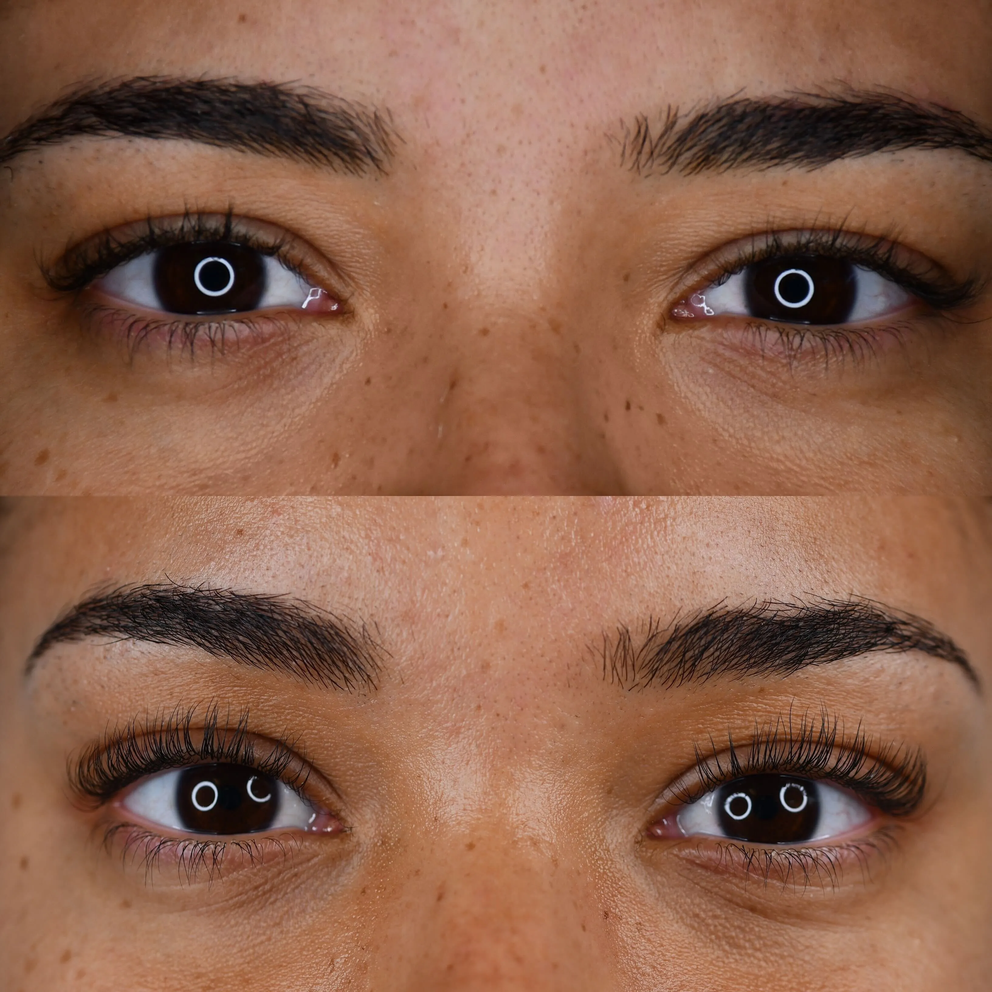 Lifted. Treatment Bundle