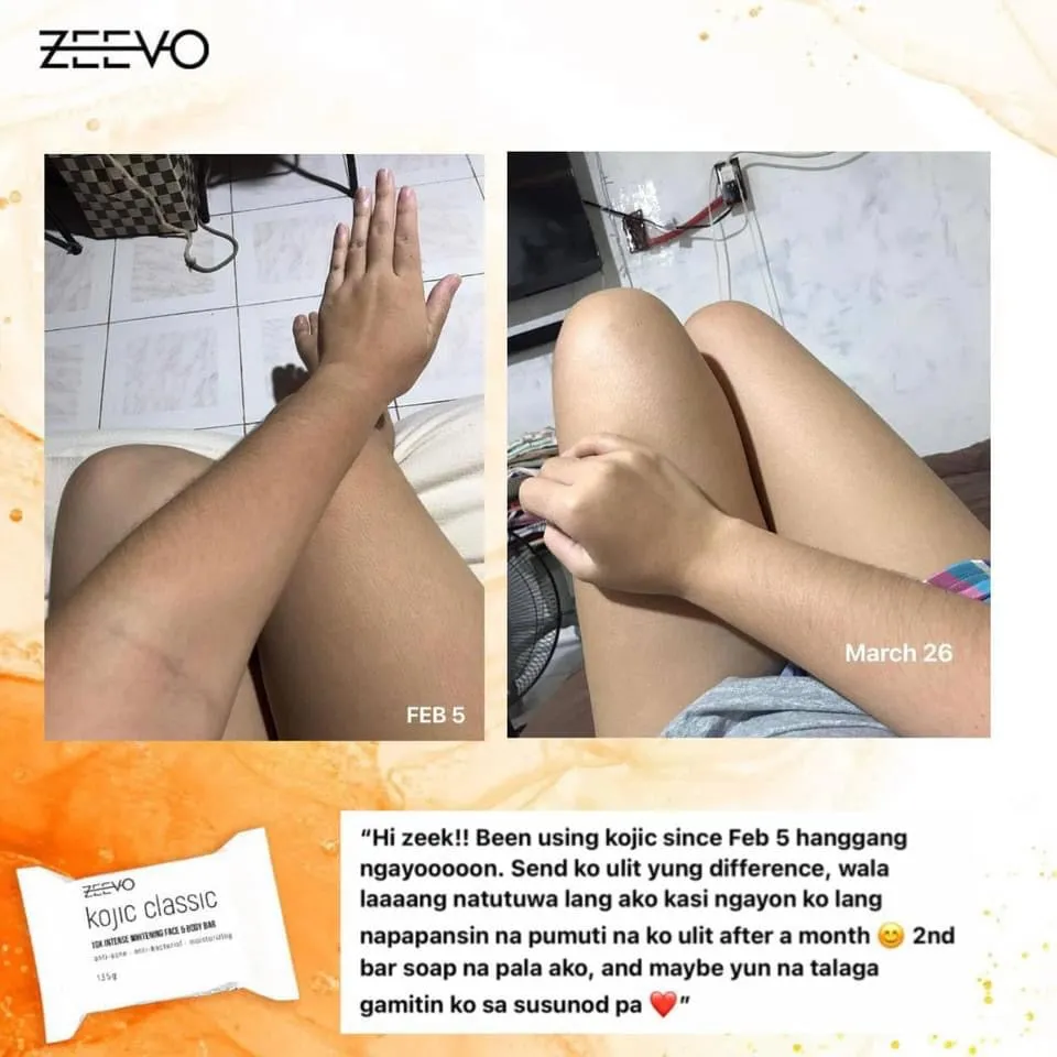 ZEEVO Kojic Classic 10x Whitening Soap 135g