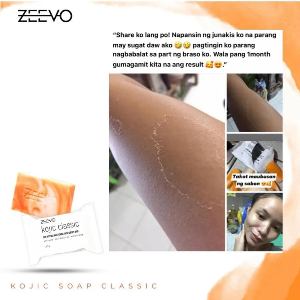 ZEEVO Kojic Classic 10x Whitening Soap 135g